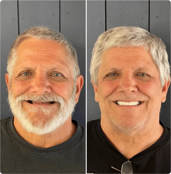 Before and After photos