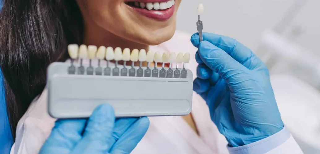 teeth-whitening